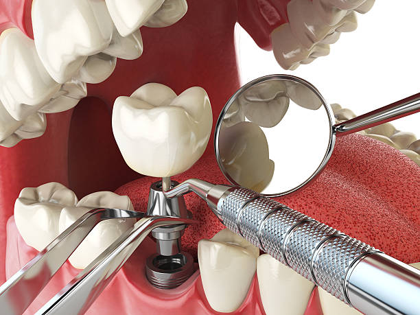 Best Emergency Treatment for Jaw Pain or Injury in Hines, OR